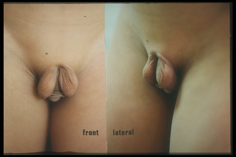 Peach shaped bottom cock testicles images