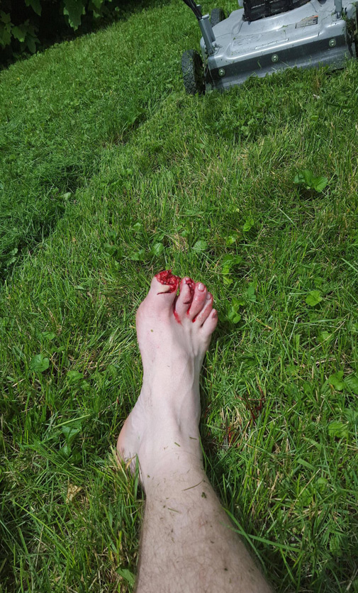 Не забудь сфоткать ногу после встречи с газонокосилкой