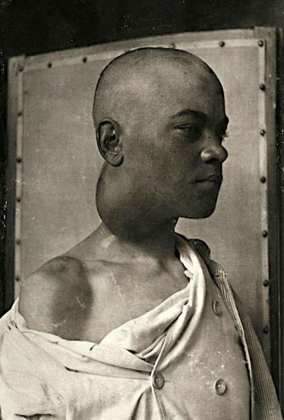 Люди с мутациями на снимках 19-го века